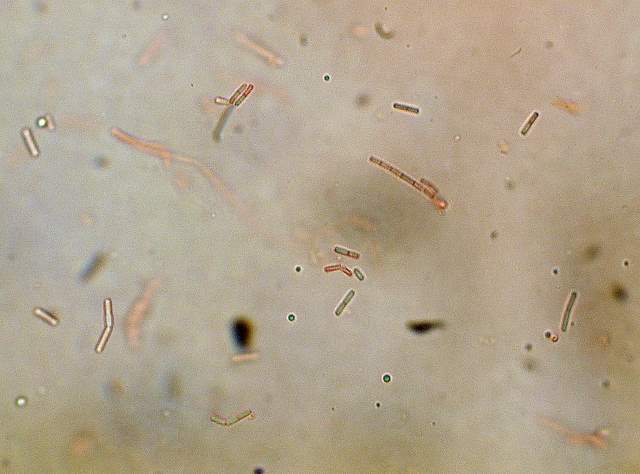 Cordyceps spec.